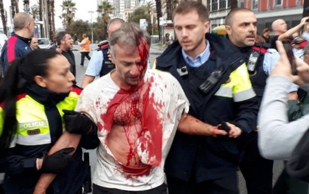 Kataloniyada yaralıların sayı 337-yə çatıb