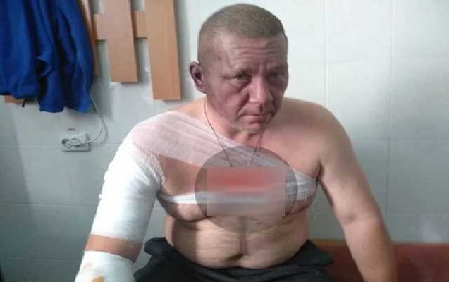 Qondarma respublikanın rəhbərliyinə namizəd yaralandı - Donetskdə partlayış