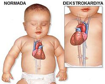 ureyini-sagda-dasiyanlar-arasdirma