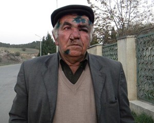 gurcustanda-azerbaycanli-aileye-silahli-basqin-oldu-fotolar