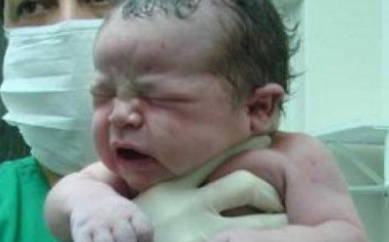 azerbaycanda-15-yasinda-3-usagi-olan-analar-da-var-