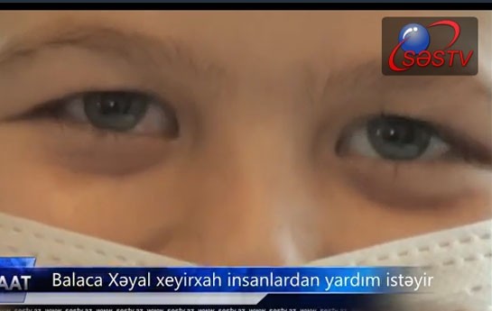 onun-komeye-ehtiyaci-var-