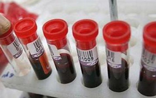 azerbaycanda-524-nefer-hepatite-yoluxub