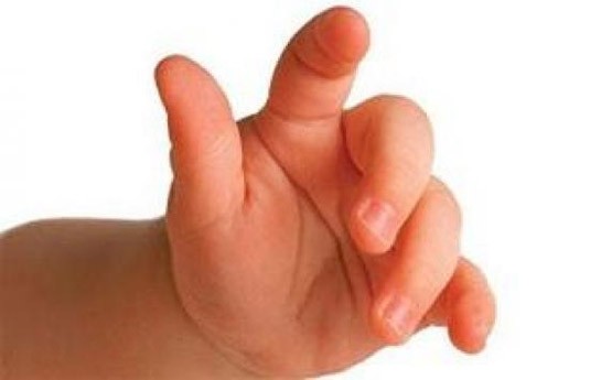 2-yasli-usaq-faciesi-