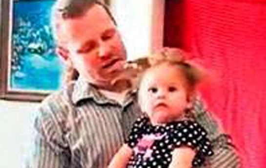 ildirim-vurdu-saclari-omurluk-dik-qaldi-