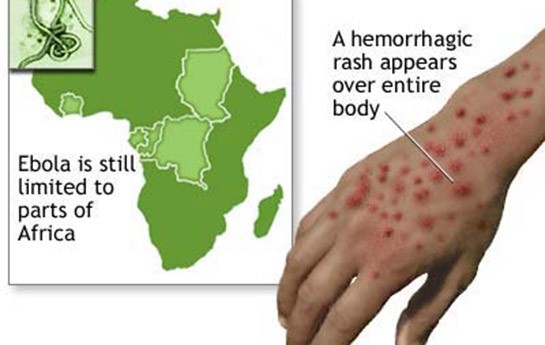 ebola-virusu-avropada