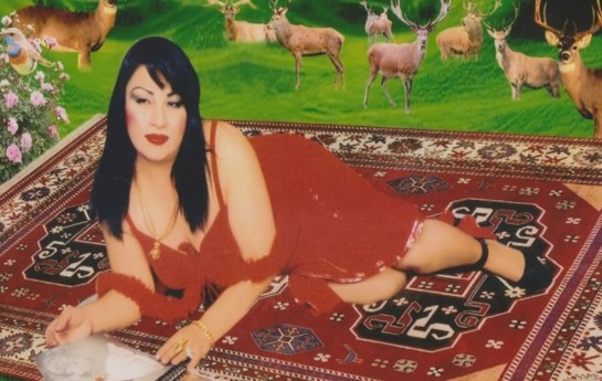hec-bir-plastik-emeliyyat-etdirmemisem-