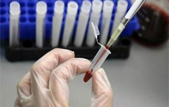 qics-ve-hiv-e-gore-nikah-pozula-biler
