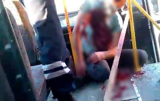 qezaya-dusen-oglanin-bedenine-mil-girdi-