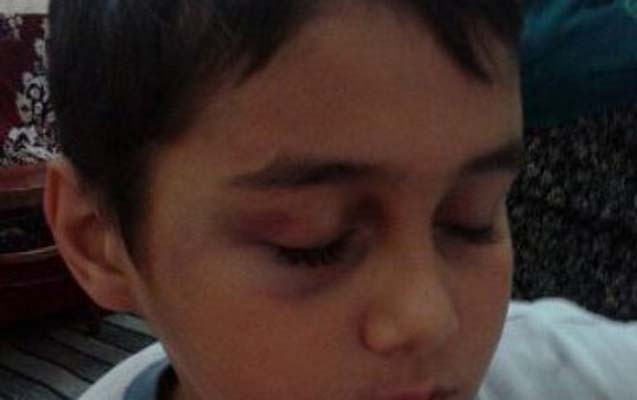 sumqayitda-sagirdin-doyulmesi-ile-bagli-