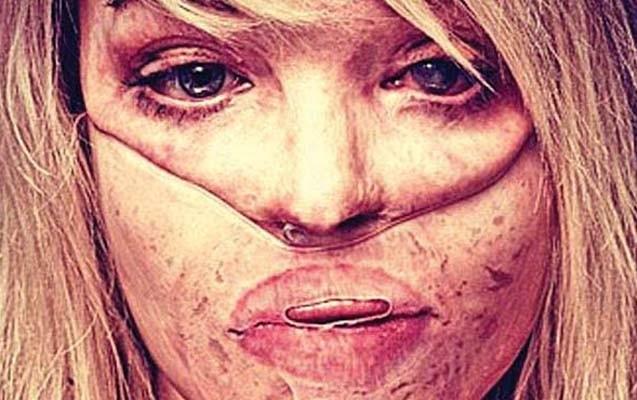 sevgilisinin-uzune-kislota-atdigi-aparici-yeniden-efirde-