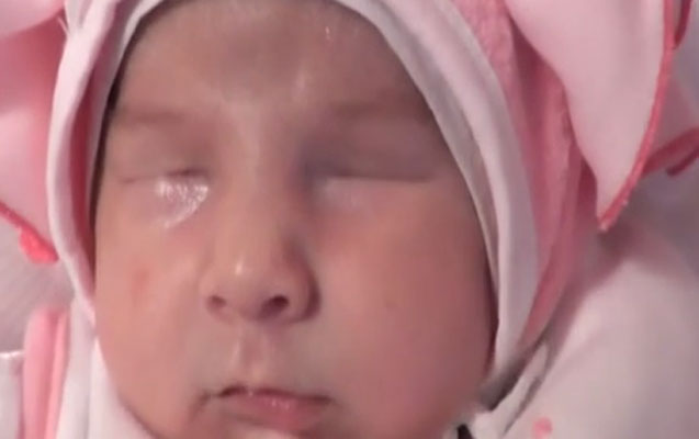dunyaya-gozsuz-gelen-korpe-