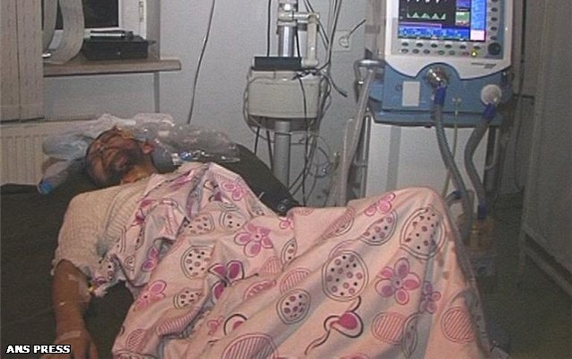 masin-yol-kenarindaki-piyadaya-cirpildi-