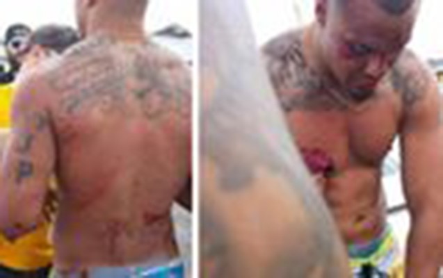 futbolcu-istemeden-doyuldu