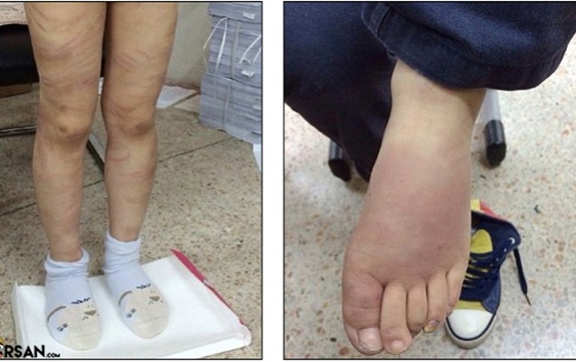 pinokyo-nagilini-bilmediyi-ucun-xortumla-doyuldu-