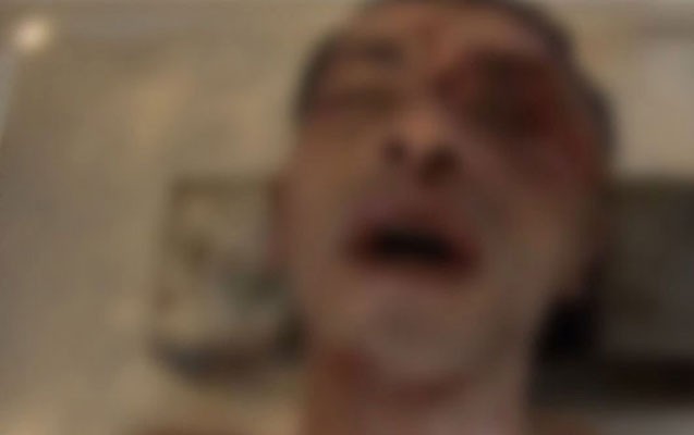 bakida-yandirilaraq-oldurulen-polisle-bagli-