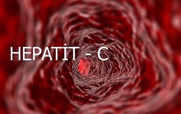 hepatitin-c-ile-bagli-iki-hekimden-ferqli-