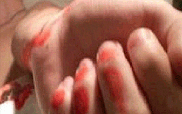 azerbaycanli-suse-ile-qolunu-dogradi-