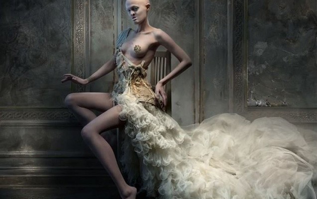 xesteliyi-meshurluguna-mane-olmadi-