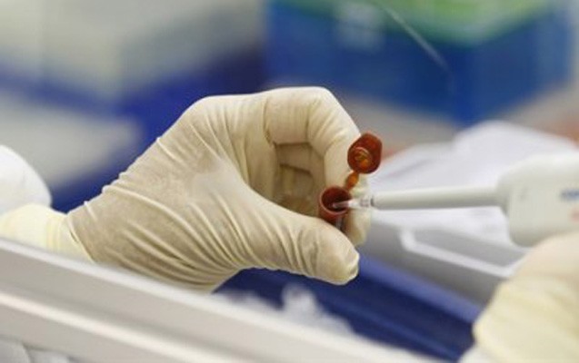 azerbaycanda-peyvend-neceyedir