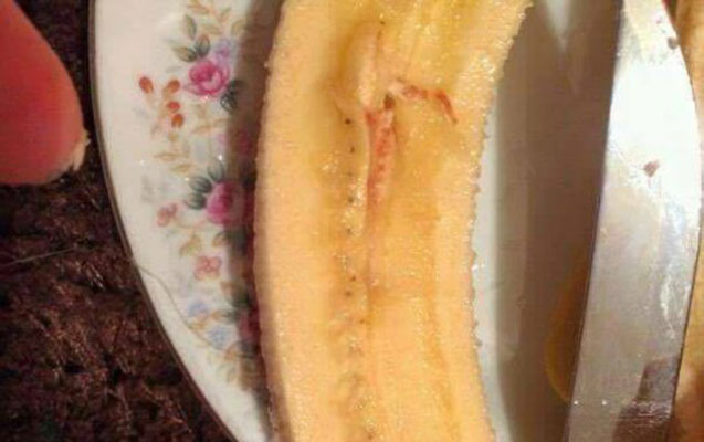 banandaki-qan-lekesi-haqda-