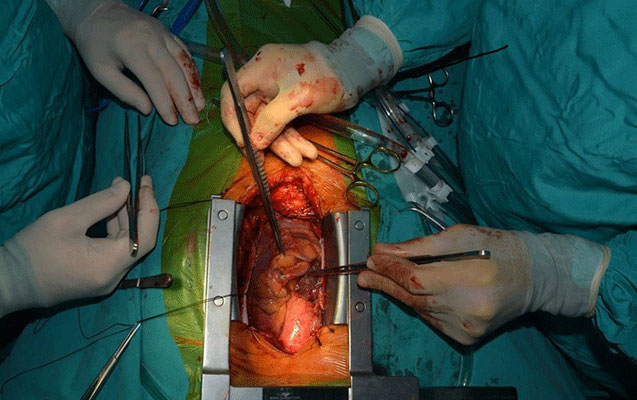 azerbaycanda-nadir-emeliyyat-heyata-kecirildi