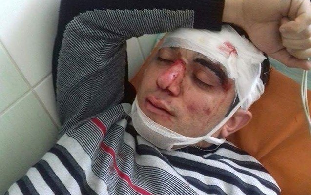 gullelenen-azerbaycanlilarin-adlari-melum-oldu