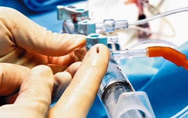 xercenge-qarsi-yeni-usul