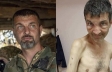 4 ay Rusiya əsirliyi “Azov döyüşçüsü”nü tanınmaz hala saldı
