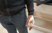 sekide-canavar-kende-hucum-etdi