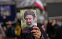 Ayağı əməliyyat edilib, protez gözləyir