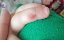 “3 yaşlı uşağım bağçada ağlayanda bıçağı qızdıraraq əlinə basıb”