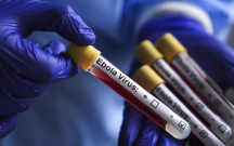 epidemiya-gorunmemis-suretle-yayilir