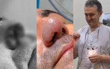 burnunu-it-disleyen-xesteye-yenisi-formalasdirildi