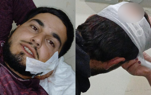 agdamda-2-qardas-12-manata-gore-bicaqlandi