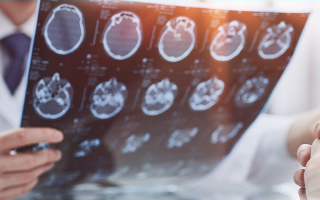 insultun-muayine-ve-mualicesi-icbari-tibbi-sigorta-ile-qarsilanir