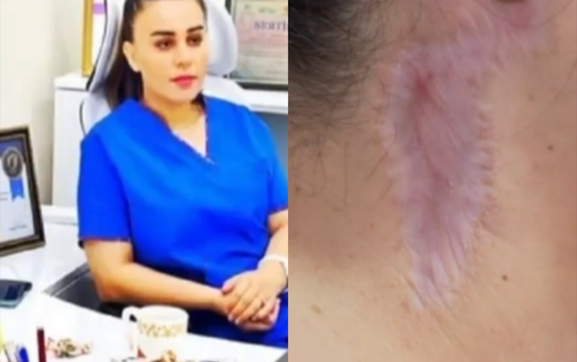 meni-gozellik-salonunda-emeliyyat-etdi-agzim-eyilir