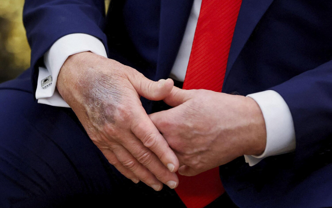 yene-elleri-ile-gundem-oldu