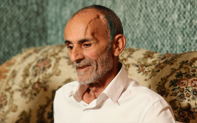 icbari-tibbi-sigorta-ile-beyin-emeliyyati-olundu