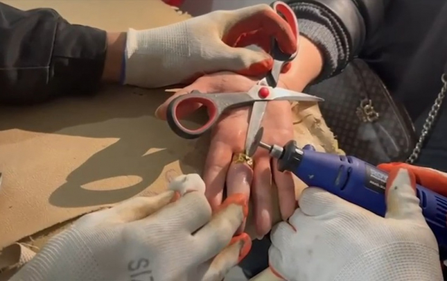 barmaginda-sixisan-uzuyu-bele-cixardilar