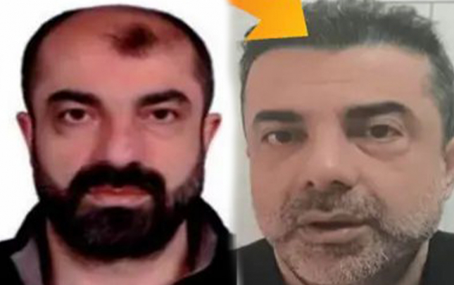 estetik-emeliyyatlarla-7-il-gizlene-bildi