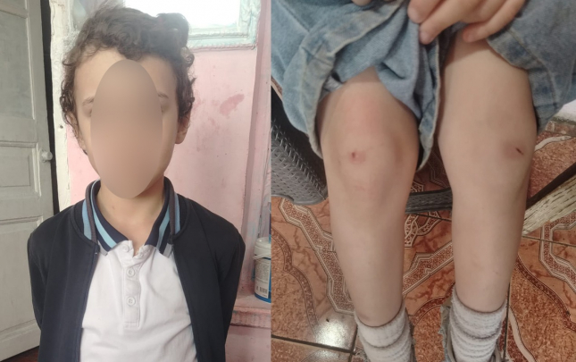 4-cu-sinif-sagirdi-nevemi-mektebin-ayaqyolunda-doyub