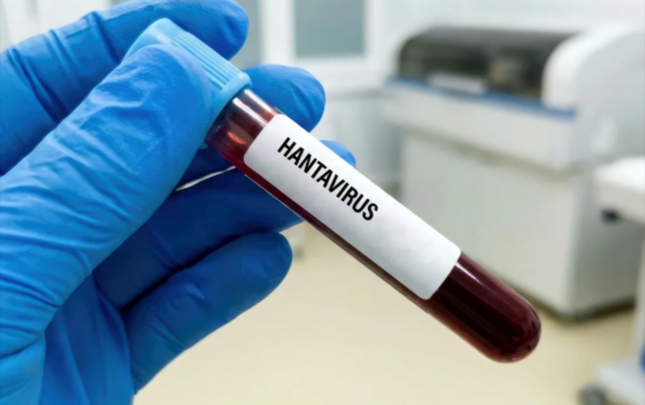 hantavirus-insandan-insana-nadir-halda-kecir