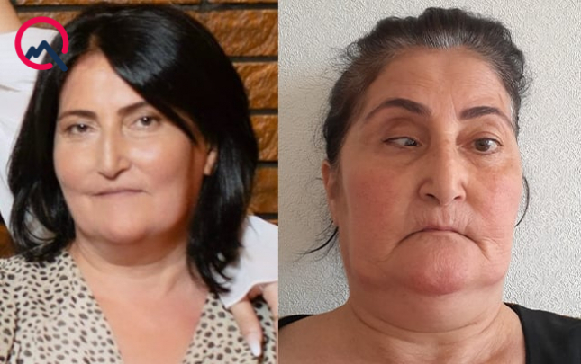bu-klinika-tezminat-odeyecek