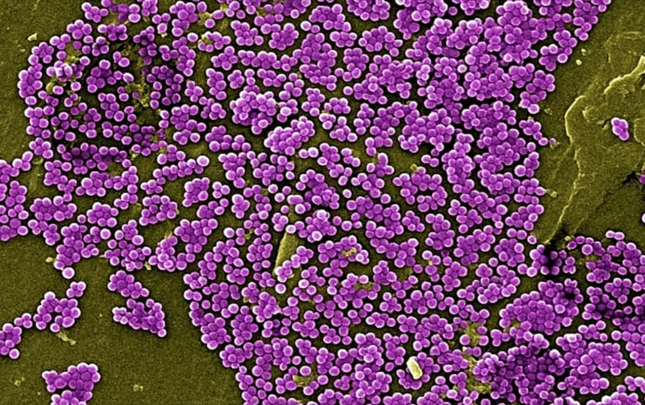 Antibiotiksiz müalicə üsulu tapıldı