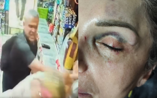 qadini-magazada-doydu