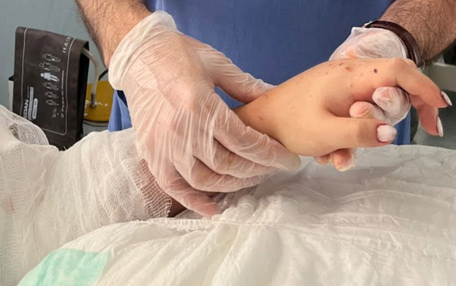Bakıda qızın qopmuş qolu yerinə bərpa olundu  – Foto