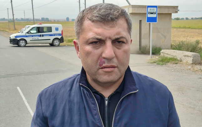 ehali-hazirda-tehlukesiz-seraitdedir
