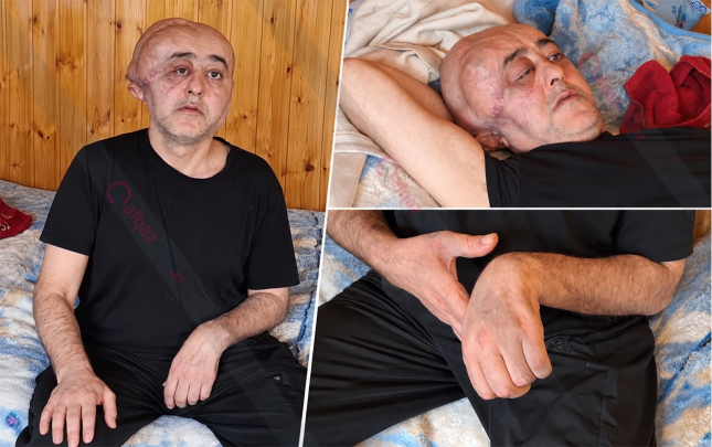 5-ildir-yataq-xestesidir-pensiya-ala-bilmir