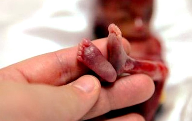 azerbaycanda-abortlarin-sayi-artir